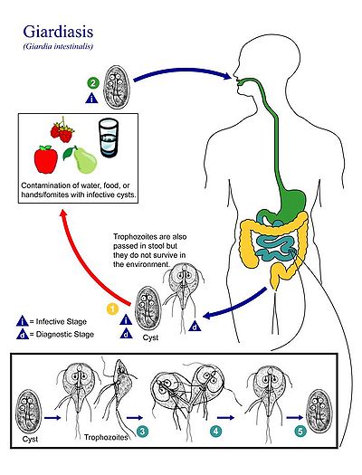 Criptosporidiu și giardia în apă - Tratament criptosporidiu și giardia