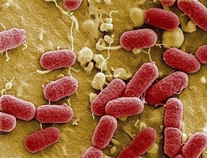 analsisis-e.coli-microbiologico-laboratorio