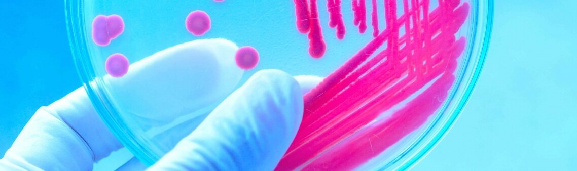 Analisis Superficies Laboratorio Especializado Siggo